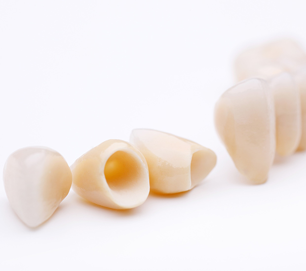 Chicago Dental Crowns and Dental Bridges