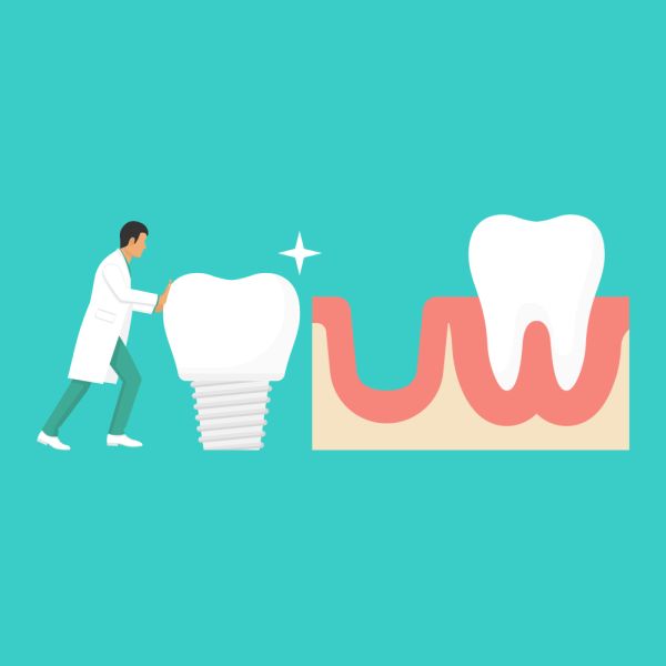 Dental Implants Professional Chicago, IL