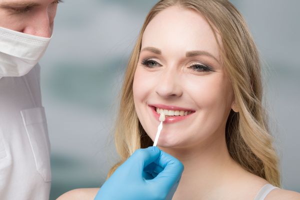 The   Most Commonly Asked Questions About Dental Veneers