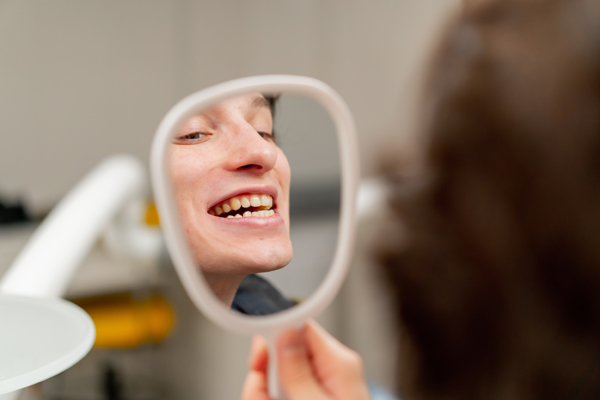 The Process Of Getting Dental Veneers: What To Expect