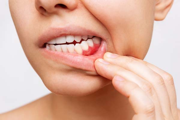 Is There A Relationship Between Gum Disease And Diabetes?