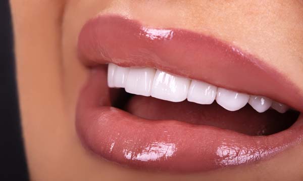 See Your Dentist For A Smile Makeover Consultation